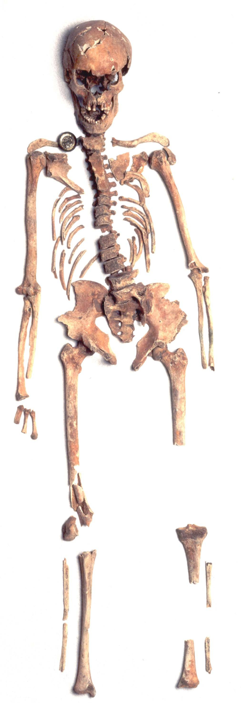 Saxon ancestor Saxon ancestor